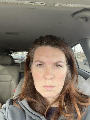 Non matching eyebrows