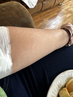 my arm got swollen and hurt so much?