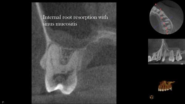 Glendale Endodontics & Microsurgery - David Abdelmalak,DDS