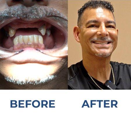 America's First Dental Implant Centers