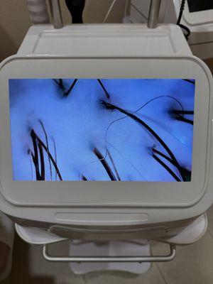 My hair after the treatment