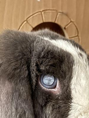 Right-eye cataract before surgery, no vision out of this eye at the time. (2 months after cataract were diagnosed).