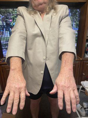 My favorite suit, my arm have grown so long. Don't take your clothes to this company