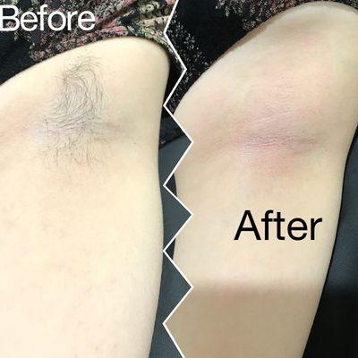 A client that is typically extremely sensitive to waxing, had very little reaction with my current wax.