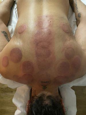 Pura Acupuncture & Wellness