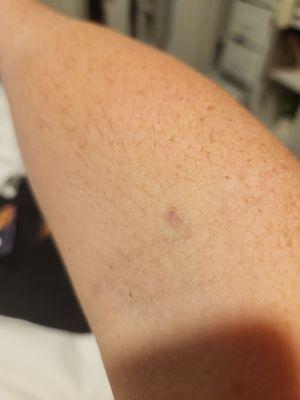 Cheryl Ann Brewer, MD