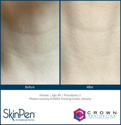 Eterne Wellness By Chero