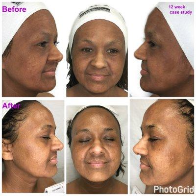 SHOW A LITTLE SKINcare