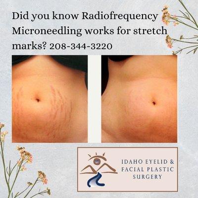 Mark J Boerner, MD- Idaho Eyelid and Facial Plastic Surgery