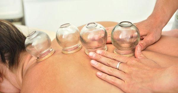 Cupping, ice therapy, stretching and much more!