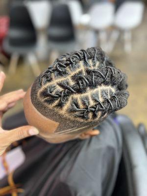 Hair line restoration