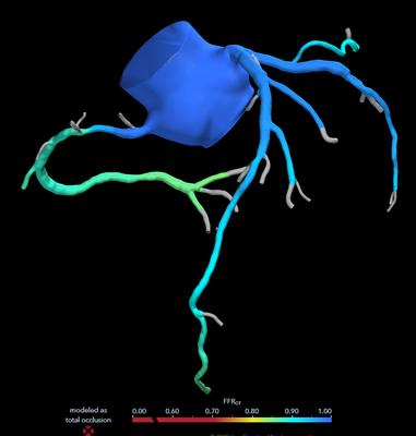 Daniel Karlsberg, MD FACC