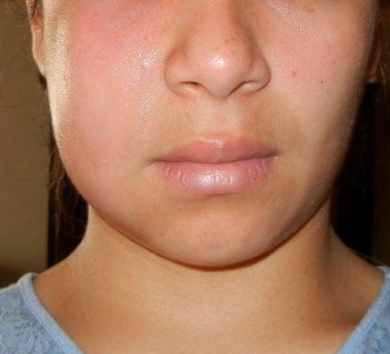 swelling after visiting Dr. Scam's office!