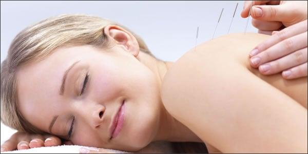 Acupuncture in Fort Lauderdale at Ocean Acupuncture and Wellness Center, LLC