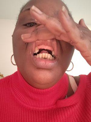 This doctor took all my teeth out while I was under Anastasia they are fraudulent and they will lie and steal your money and teeth