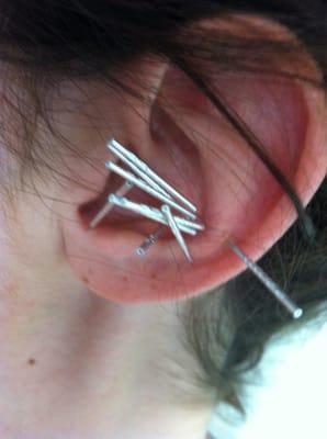 Libertyville Acupuncture