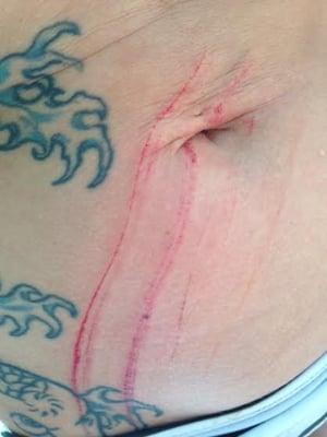 swam in the river and cut my stomach on a rusty pipe at twin oaks campground.