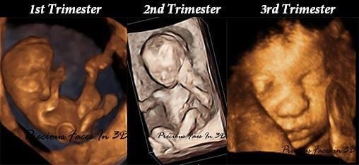 Precious Faces In 3D