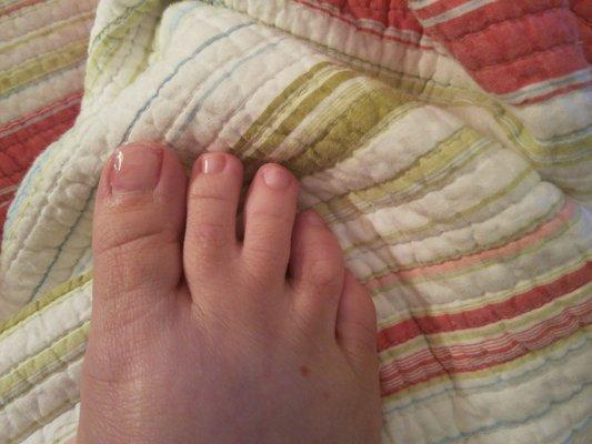 Big toenail restored!