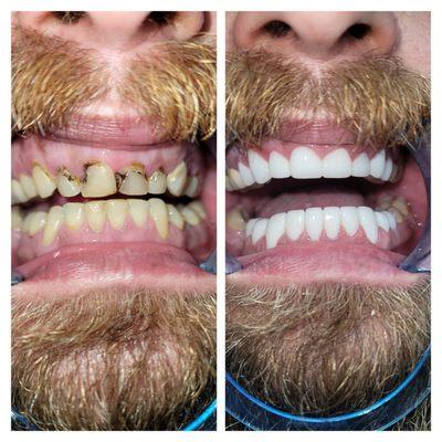 Michael Shirvani, DDS - All Smiles Dental Group