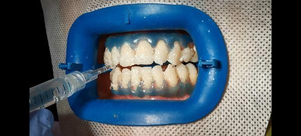 Lake Balboa Dental Group