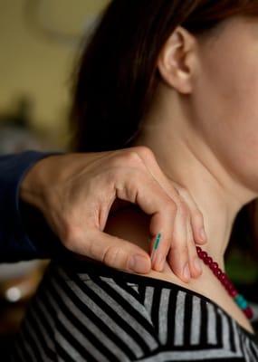 Eastern Sun Acupuncture