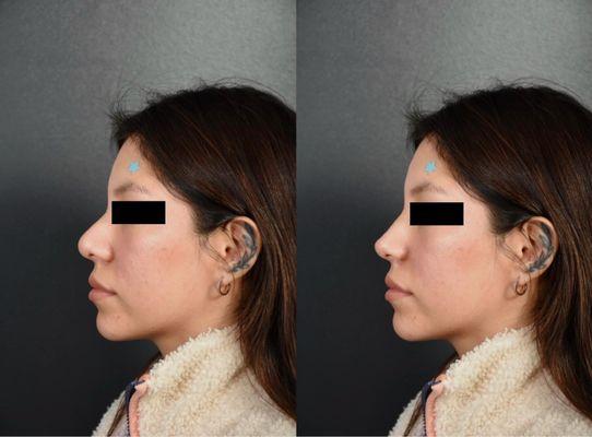 Profiles Beverly Hills