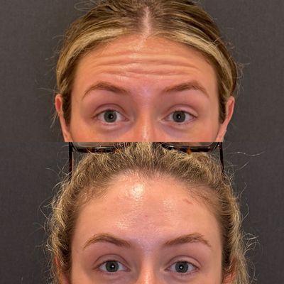 Renew Laser and Aesthetic Medicine