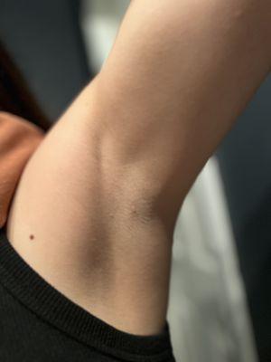 Fuentes Laser Hair Removal