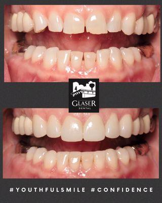 Natural looking upgrade:)