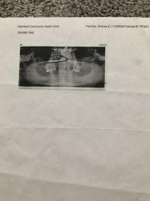 Osf Saint Francis Medical Center