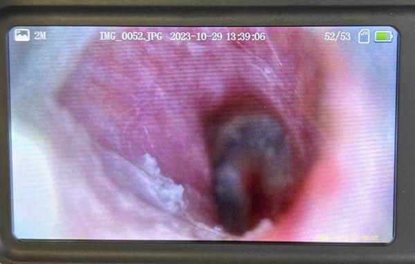 After getting Swished! What a beautiful ear drum!