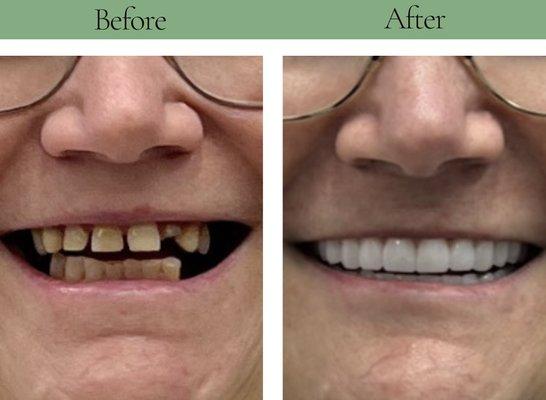 Terri G. before and after