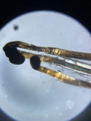 Polarized light microscopy. Used to track and gain unique information relating to hair loss, shedding and scalp conditions.