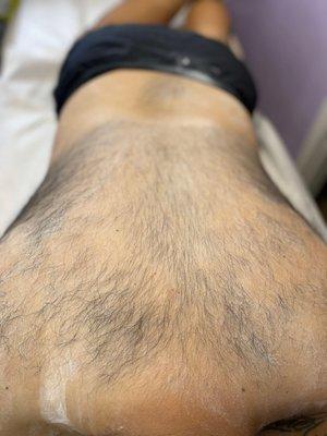 Gentleman's full back wax before..