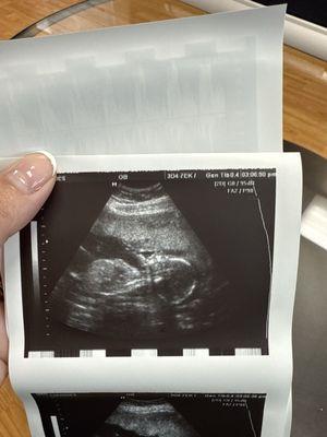 Prenatal Ultrasound of Glendale