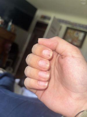 First Nails