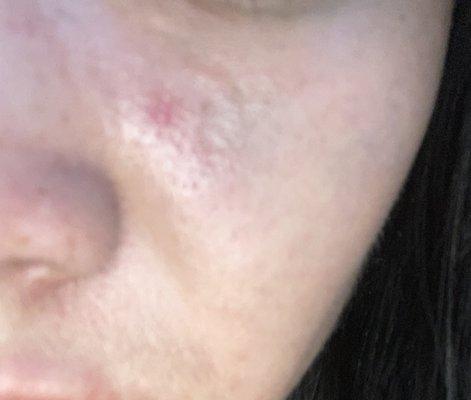 Dermatology Specialists