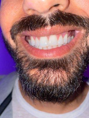 Oxy Dental of North Hollywood