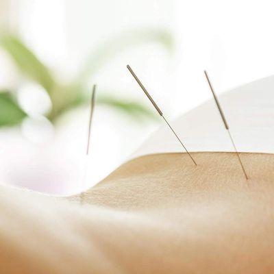 LouLou Piscatore L.Ac