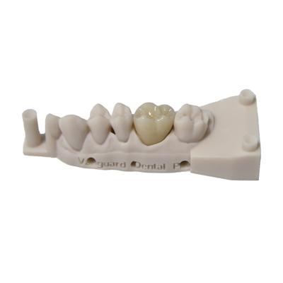Vanguard Dental Prosthetics