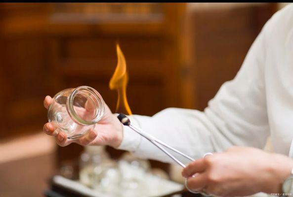 Fire cupping