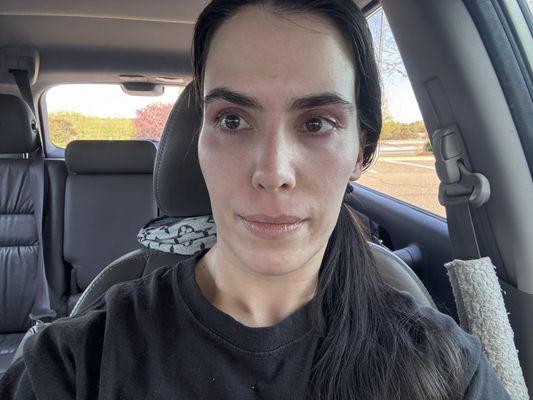 Overall view of brows after threading