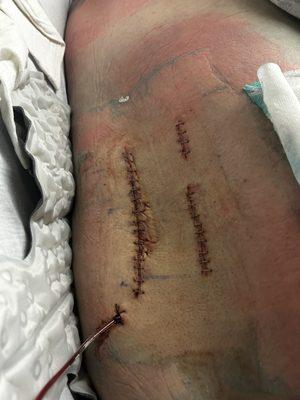 St. Charles Outpatient Rehabilitation