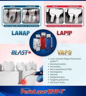 We save the Hopeless teeth & Implants and avoid extractions. Because it deserves a second chance and little TLC.