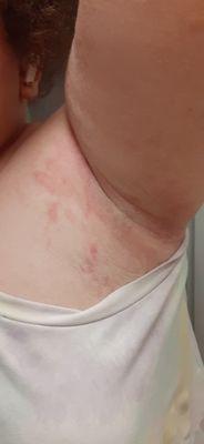 Sent these pictures to corporate they didn't care all they cared about was their money