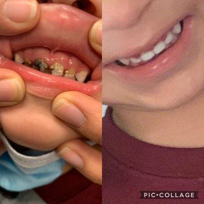 Powell Pediatric Dentistry