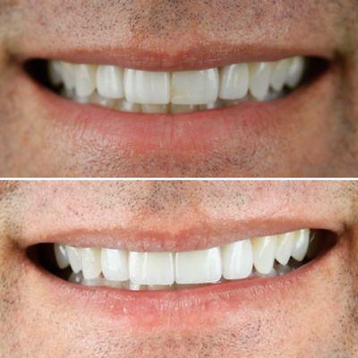 Kallos Dental Aesthetics