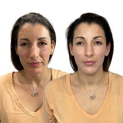 DOTH : Injection Studio