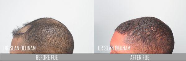 Dermatology & Hair Restoration Specialists - Dr. Sean Behnam